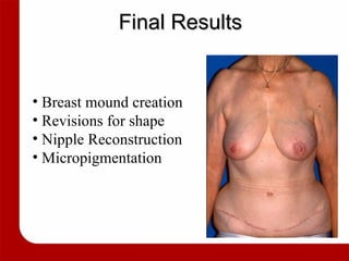 Final Results Breast mound creation Revisions for shape Nipple Reconstruction Micropigmentation 