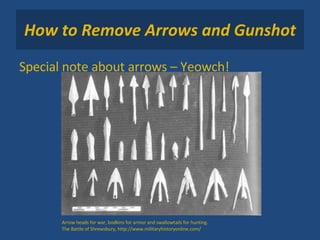 How to Remove Arrows and Gunshot Special note about arrows – Yeowch! Arrow heads for war, bodkins for armor and swallowtails for hunting. The Battle of Shrewsbury, http://www.militaryhistoryonline.com/ 