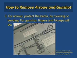 How to Remove Arrows and Gunshot 3. For arrows, protect the barbs, by covering or bending. For gunshot, fingers and forceps will do: Arrow and shot forceps. 16 th  C Germanisches National Museum Scott Moore, Photographer 