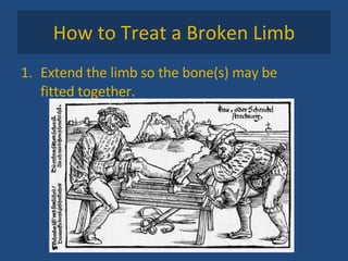 How to Treat a Broken Limb Extend the limb so the bone(s) may be fitted together.  