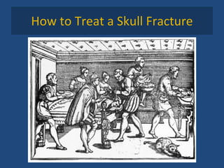 How to Treat a Skull Fracture 
