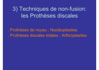 3) Techniques de non-fusion:
      les Prothèses discales

. Prothèses de noyau : Nucléoplasties
. Prothèses discales totales : Arthroplasties
 