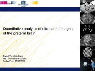 Quantitative analysis of ultrasound images  of the preterm brain Ewout Vansteenkiste IBBT-Medisip/IPI-UGENT Friday Food 25/01/2008 