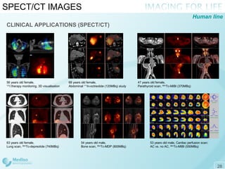 SPECT/CT IMAGES CLINICAL APPLICATIONS (SPECT/CT) 56 years old female,  131 I therapy monitoring, 3D visualisation 68 years old female,  Abdominal  111 In-octreotide (120MBq) study 47 years old female,  Parathyroid scan,  99m Tc-MIBI (370MBq) 54 years old male,  Bone scan,  99m Tc-MDP (800MBq) 53 years old male, Cardiac perfusion scan: AC vs. no AC,  99m Tc-MIBI (550MBq) 63 years old female, Lung scan,  99m Tc-depreotide (740MBq) Human line 