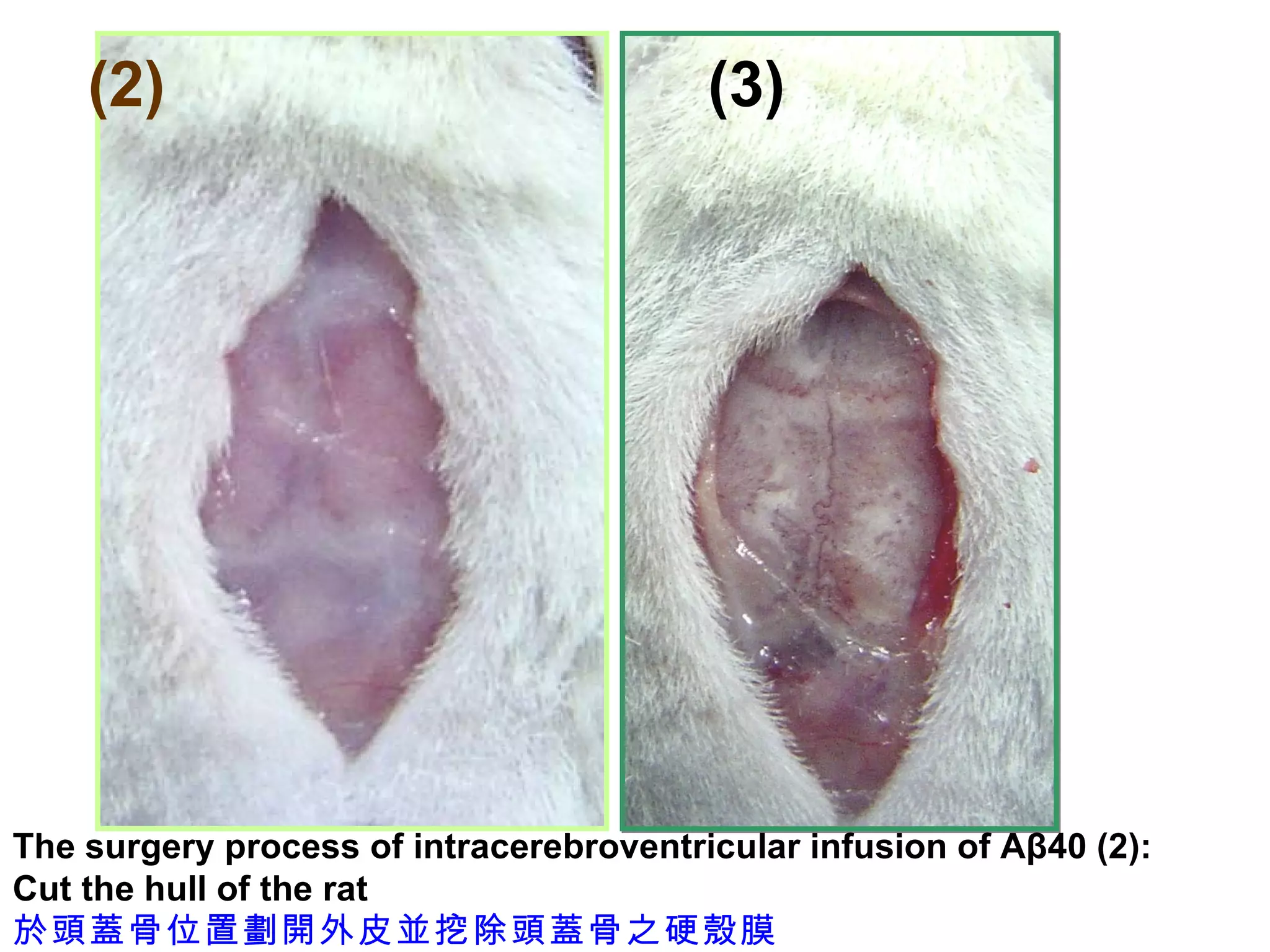 (2) (3) The surgery process of intracerebroventricular infusion of Aβ40 (2): Cut the hull of the rat 於頭蓋骨位置劃開外皮並挖除頭蓋骨之硬殼膜 