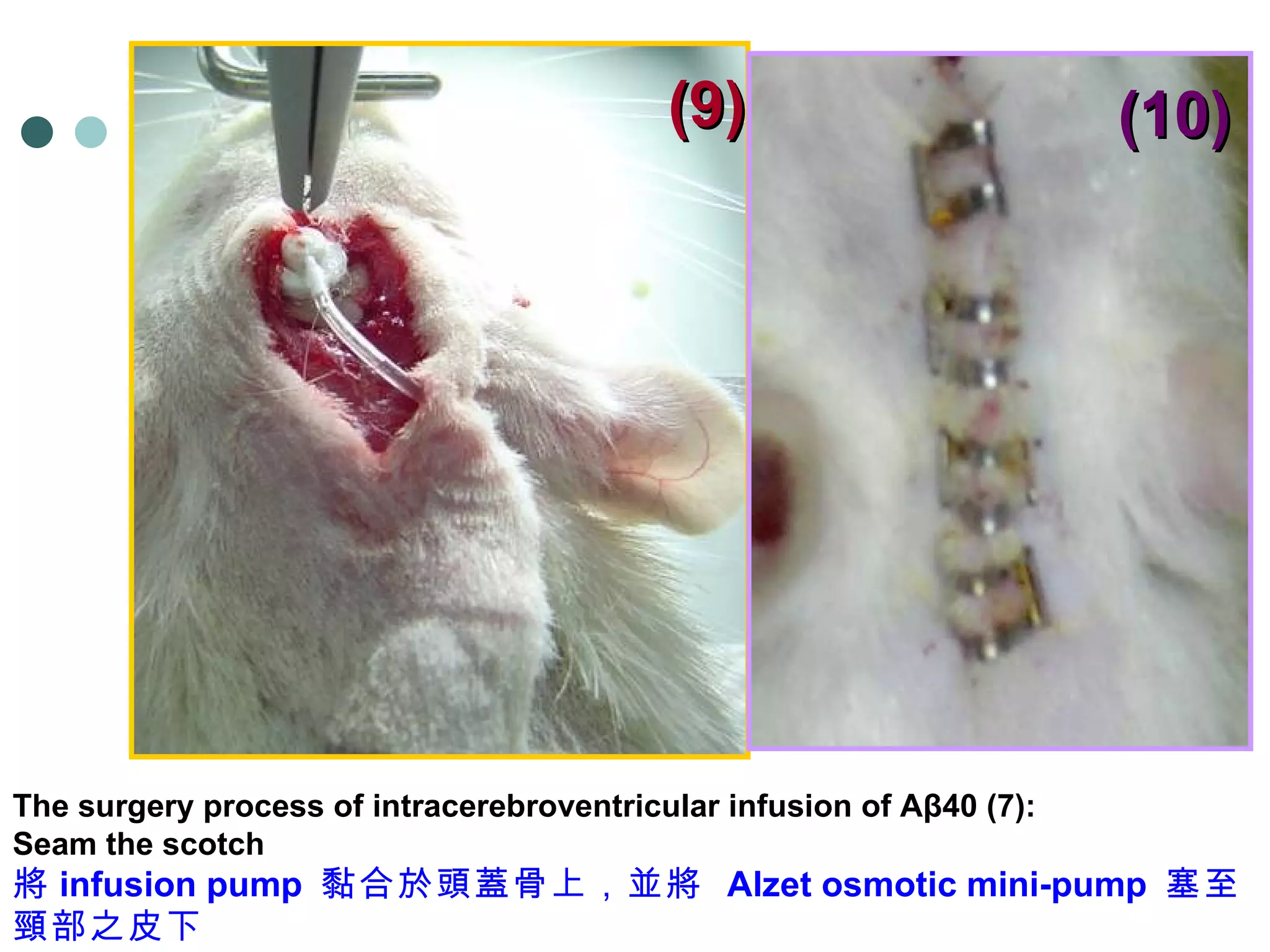 (9) (10) The surgery process of intracerebroventricular infusion of Aβ40 (7): Seam the scotch 將 infusion pump  黏合於頭蓋骨上，並將  Alzet osmotic mini-pump  塞至頸部之皮下 