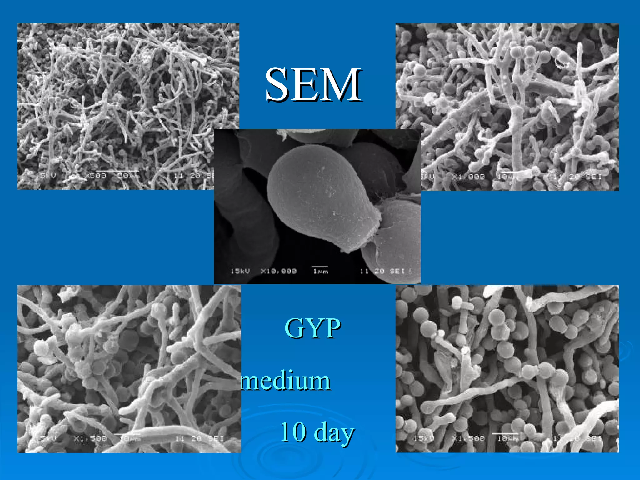 SEM GYP  medium  10 day 