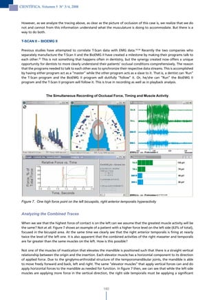 CIENTÍFICA, Volumen 5 N° 3/4, 2008



 However, as we analyze the tracing above, as clear as the picture of occlusion of this case is, we realize that we do
 not and cannot from this information understand what the musculature is doing to accommodate. But there is a
 way to do both.

 T-SCAN II – BIOEMG II

 Previous studies have attempted to correlate T-Scan data with EMG data.33,34 Recently the two companies who
 separately manufacture the T-Scan II and the BioEMG II have created a milestone by making their programs talk to
 each other.35 This is not something that happens often in dentistry, but the synergy created now offers a unique
 opportunity for dentists to more clearly understand their patients’ occlusal conditions comprehensively. The reason
 that the programs needed to talk to each other was to synchronize their respective data streams. This is accomplished
 by having either program act as a “master” while the other program acts as a slave to it. That is, a dentist can ‘Run”
 the T-Scan program and the BioEMG II program will dutifully “follow” it. Or, he/she can “Run” the BioEMG II
 program and the T-Scan II program will follow it. This is true in recording as well as in playback analysis.



                  The Simultaneous Recording of Occlusal Force, Timing and Muscle Activity




 Figure 7. One high force point on the left bicuspids, right anterior temporalis hyperactivity


 Analyzing the Combined Traces

 When we see that the highest force of contact is on the left can we assume that the greatest muscle activity will be
 the same? Not at all. Figure 7 shows an example of a patient with a higher force level on the left side (63% of total),
 focused in the bicuspid area. At the same time we clearly see that the right anterior temporalis is firing at nearly
 twice the level of the left one. It is also apparent that the combined activities of the right masseter and temporalis
 are far greater than the same muscles on the left. How is this possible?

 Not one of the muscles of mastication that elevates the mandible is positioned such that there is a straight vertical
 relationship between the origin and the insertion. Each elevator muscle has a horizontal component to its direction
 of applied force. Due to the ginglymo-arthroidial structure of the temporomandibular joints, the mandible is able
 to move freely forward and back, left and right. The same “elevator muscles” that apply vertical forces can and do
 apply horizontal forces to the mandible as needed for function. In figure 7 then, we can see that while the left side
 muscles are applying more force in the vertical direction, the right side temporalis must be applying a significant



                                                         180
 