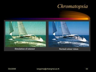 Chromatopia Color Eye assessment | PDF