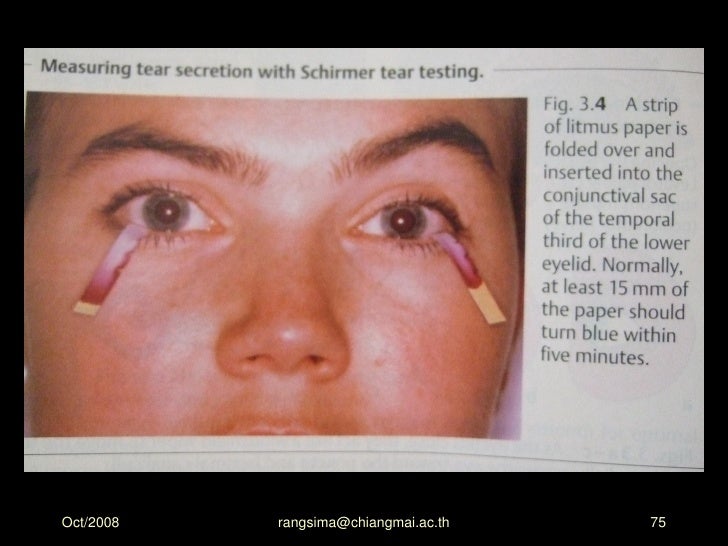 Eye assessment