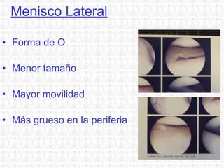 Menisco Lateral Forma de O Menor tamaño Mayor movilidad Más grueso en la periferia  