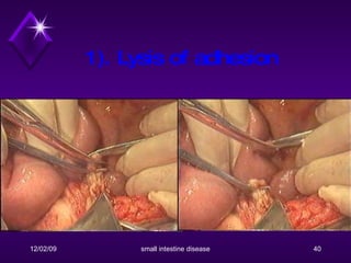 1). Lysis of adhesion 