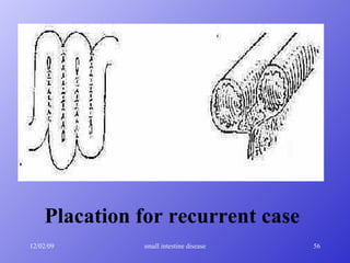 Placation for recurrent case 