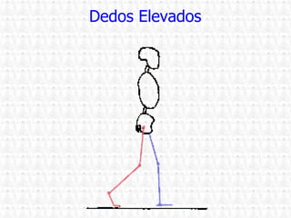 Dedos Elevados 