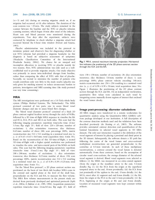 Vasodilation during migraine headache