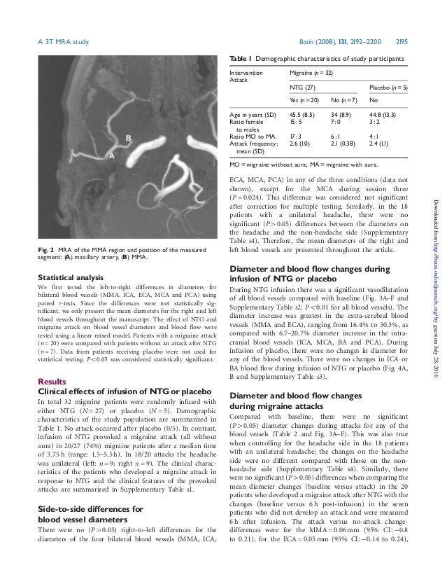Vasodilation during migraine headache