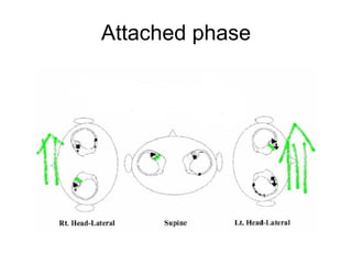 Attached phase 