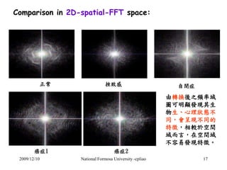 Comparison in 2D-spatial-FFT space: 
正常挫敗感 
癌症1 癌症2 
自閉症 
由轉換後之頻率域 
圖可明顯發現其生 
物生、心理狀態不 
同，會呈現不同的 
特徵，相較於空間 
域而言，在空間域 
不容易發...
