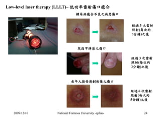 Low-level laser therapy (LLLT)– 低功率雷射傷口癒合 
糖尿病癒合不良之病患傷口 
經過3 次雷射 
照射(每次約 
3分鐘)之後 
灰指甲掉落之傷口 
經過3 次雷射 
照射(每次約 
3分鐘)之後 
老年人接受...