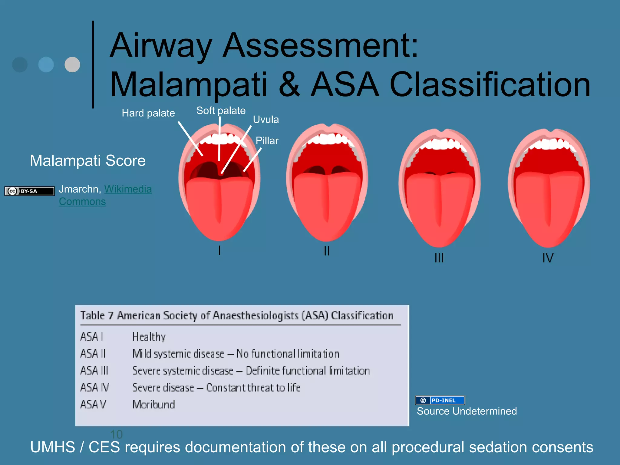 Airway Assessment: Malampati & ASA Classification 
Malampati Score 
UMHS / CES requires documentation of these on all procedural sedation consents 
10 
Hard palate 
Pillar 
Uvula 
Soft palate 
Jmarchn, Wikimedia Commons 
Source Undetermined  