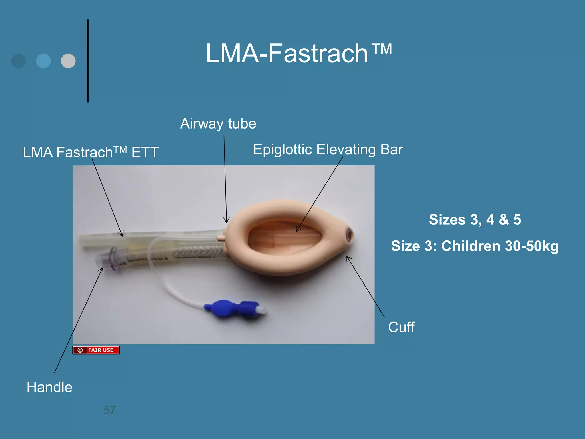 LMA-Fastrach™ 
Sizes 3, 4 & 5 Size 3: Children 30-50kg 
Airway tube 
Handle 
LMA FastrachTM ETT 
Epiglottic Elevating Bar 
Cuff 
57  