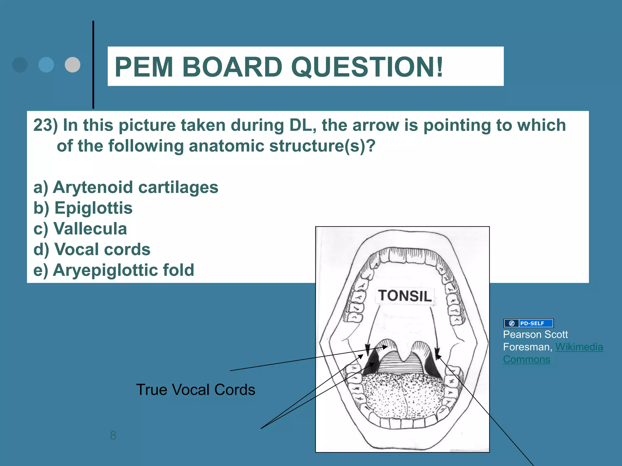 23) In this picture taken during DL, the arrow is pointing to which of the following anatomic structure(s)? a) Arytenoid cartilages b) Epiglottis c) Vallecula d) Vocal cords e) Aryepiglottic fold 
PEM BOARD QUESTION! 
True Vocal Cords 
Pearson Scott Foresman, Wikimedia Commons 
8  