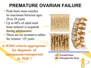 PREMATURE OVARIAN FAILURE
  Peak bone mass reaches
  its maximum between ages
  20 to 29 years
  Up to 60% of adult total
  bone mineral is acquired
  during adolescence
  There are no normative tables
  for women <25 years

is WHO criteria appropriate
       for diagnosis of
   osteopaenia/osteoporosis       (A) Normal bone
           in POF ?               (B) Osteoporotic bone
 
