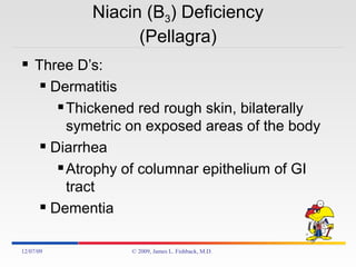 Niacin (B 3 ) Deficiency (Pellagra) Three D’s: Dermatitis Thickened red rough skin, bilaterally symetric on exposed areas of the body Diarrhea Atrophy of columnar epithelium of GI tract  Dementia 06/07/09 © 2009, James L. Fishback, M.D. 