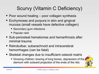 Scurvy (Vitamin C Deficiency) Poor wound healing – poor collagen synthesis Ecchymoses and purpura in skin and gingival mucosa (small vessels have defective collagen) Secondary gum infections Papular rash Sub-periosteal hematomas and hemarthrosis after minimal trauma Retrobulbar, subarachnoid and intracerebral hemorrhages (can be fatal) Skeletal changes due to insufficient osteoid matrix Growing children: bowing of long bones, depression of the sternum with outward projection of the ends of the ribs 06/07/09 © 2009, James L. Fishback, M.D. 
