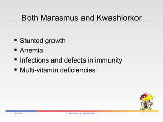 Both Marasmus and Kwashiorkor Stunted growth Anemia Infections and defects in immunity Multi-vitamin deficiencies 06/07/09 © 2009, James L. Fishback, M.D. 