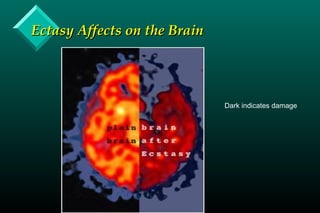 Ectasy Affects on the BrainEctasy Affects on the Brain
Dark indicates damage
 