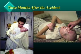 Three Months After the AccidentThree Months After the Accident
 