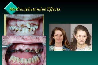 Methamphetamine Effects 