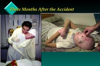 Three Months After the Accident 