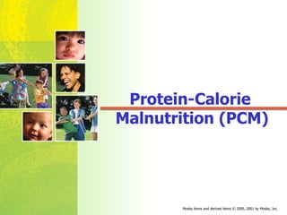 Protein-Calorie  Malnutrition (PCM) 