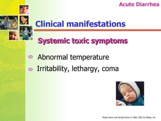 Clinical manifestations Systemic toxic symptoms Abnormal temperature Irritability, lethargy, coma Acute Diarrhea 