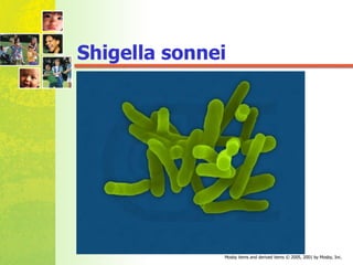Shigella sonnei 