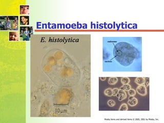 Entamoeba histolytica 