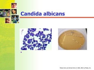 Candida albicans 