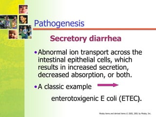 Secretory diarrhea Abnormal ion transport across the intestinal epithelial cells, which results in increased secretion, decreased absorption, or both.  A classic example  enterotoxigenic E coli (ETEC ).  Pathogenesis 