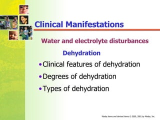 Dehydration Clinical features of dehydration  Degrees of dehydration Types of dehydration Clinical Manifestations Water and electrolyte disturbances 