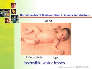 Normal routes of fluid excretion in infants and children. Lungs Skin Urine & feces insensible water losses 