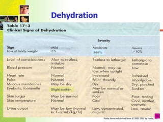 Dehydration 5-10% Slight sunken 