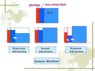 Hypertonic dehydration Isotonic  dehydration Hypotonic dehydration humour distribute Interstitial fluid plasma ICF 