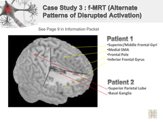 Case Study 3 : f-MRT (Alternate Patterns of Disrupted Activation)See Page 9 in Information PacketPatient 1Superior/Middle Frontal Gyri