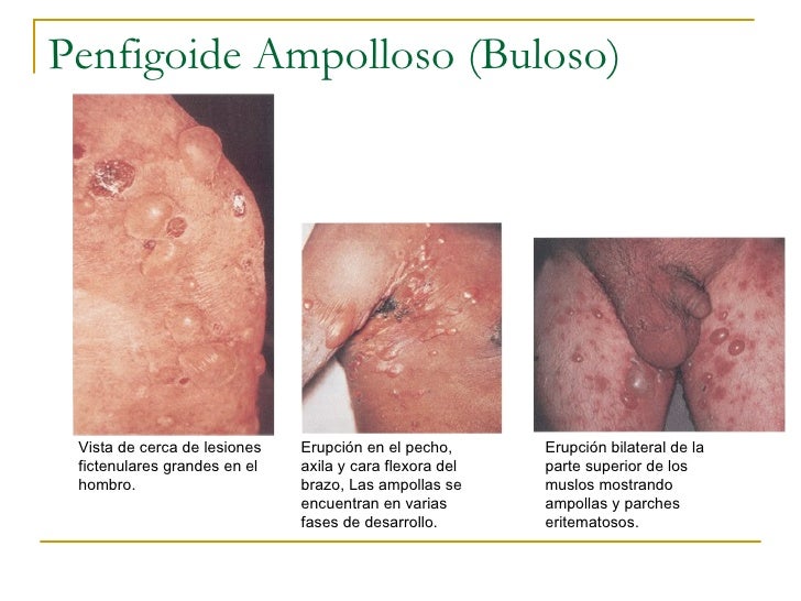 El dolor en la parte inferior derecha de la ingle da en los riñones