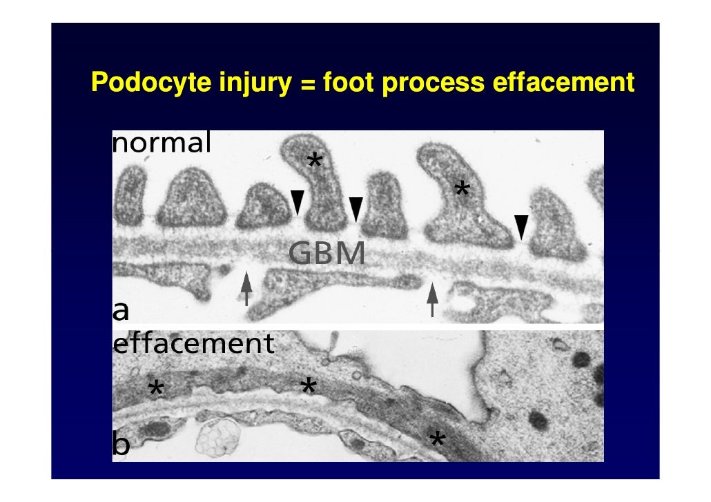 2009 Convegno Malattie Rare Barisoni [23 01]