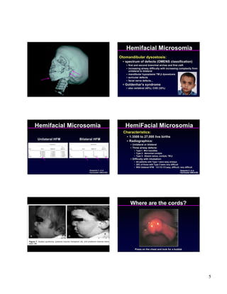 Hemifacial Microsomia
                                               Otomandibular dysostosis:
                                                • spectrum of defects (OMENS classification)
                                                  • first and second branchial arches and first cleft
                                                  • increasing airway difficulty with increasing complexity from
                                                    unilateral to bilateral
                                                  • mandibular hypoplasia/ TM jt dysostosis
                                                  • auricular defects
                                                  • facial nerve defects...
                                                • Goldenhar’s syndrome
                                                  • also vertebral (40%), CHD (35%)




Hemifacial Microsomia                             HemiFacial Microsomia
                                                 Characteristics:
                                                   • 1:3500 to 27,000 live births
Unilateral HFM   Bilateral HFM
                                                   • Radiographics:
                                                     • Unilateral or bilateral
                                                     • Three airway defects:
                                                        • Type I: Mini-mandible
                                                        • Type 2: Abnormal condyle
                                                        • Type 3: Absent ramus, condyle, TM jt
                                                     • Difficulty with intubation:
                                                        • All patients with Type 1 were easy airways
                                                        • 25% of those with Type 3 were very difficult
                                                        • With bilateral HFM: 1/3:1/3:1/3 easy, difficult, very difficult
                       Nargozian C, et al.                                                                 Nargozian C, et al.
                       Ped Anesth 1999:9;393                                                               Ped Anesth 1999:9;393




                                                     Where are the cords?




                                                         Press on the chest and look for a bubble




                                                                                                                                   5
 