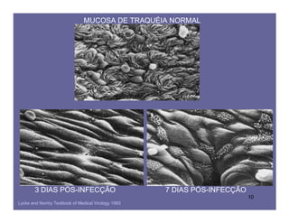 MUCOSA DE TRAQUÉIA NORMAL




        3 DIAS PÓS-INFECÇÃO                          7 DIAS PÓS-INFECÇÃO
                                                                           10
Lycke and Norrby Textbook of Medical Virology 1983
 