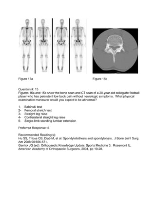 Figure 15a                                           Figure 15b


Question #: 15
Figures 15a and 15b show the bone scan an...